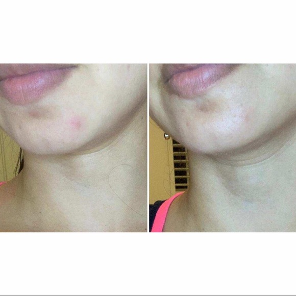 💄 SALE💄 NWT Truly Clear Truly Gone Zone Patches - Picture 6 of 14